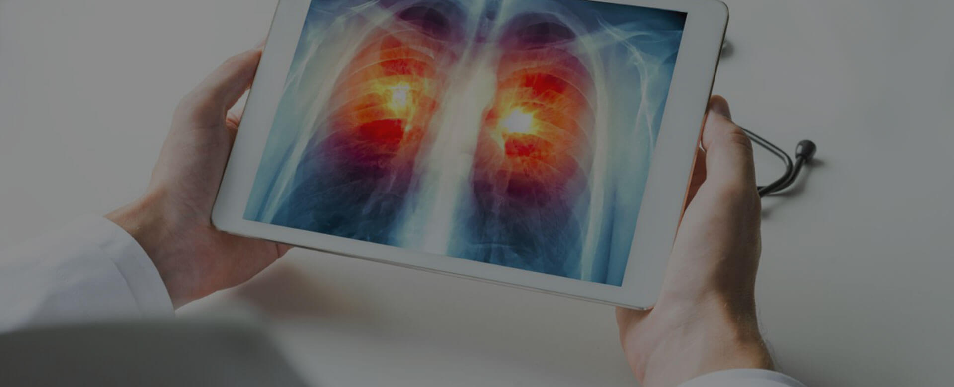 Lung cancer: smoke leaves traces in healthy cells