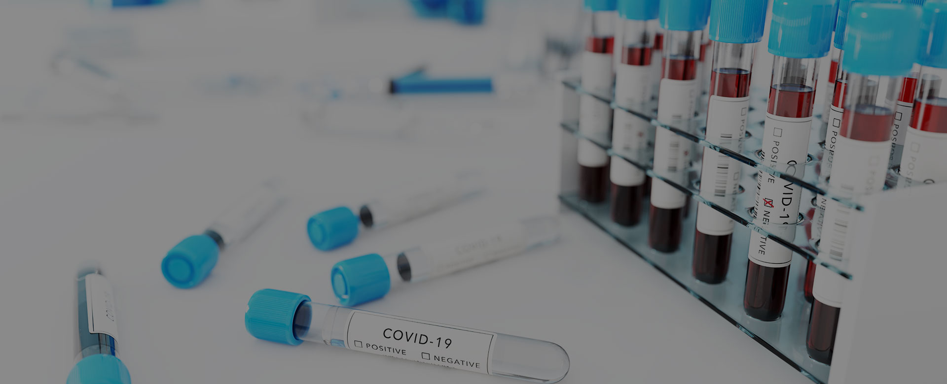 COVID-19: attivazione test sierologici e tamponi biomolecolari