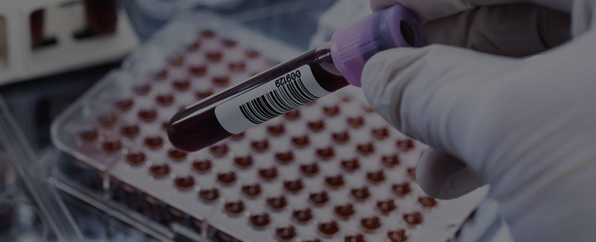 Covid-19 and cancer, liquid biopsy makes delayed diagnosis avoidable