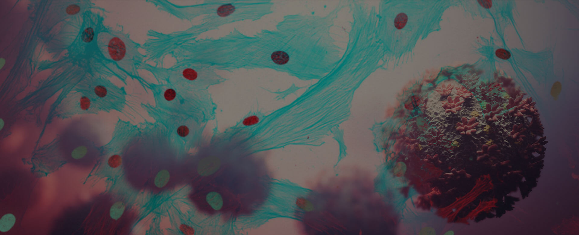 Covid-19, mesenchymal stem cells reduce the risk of death and quicken recovery