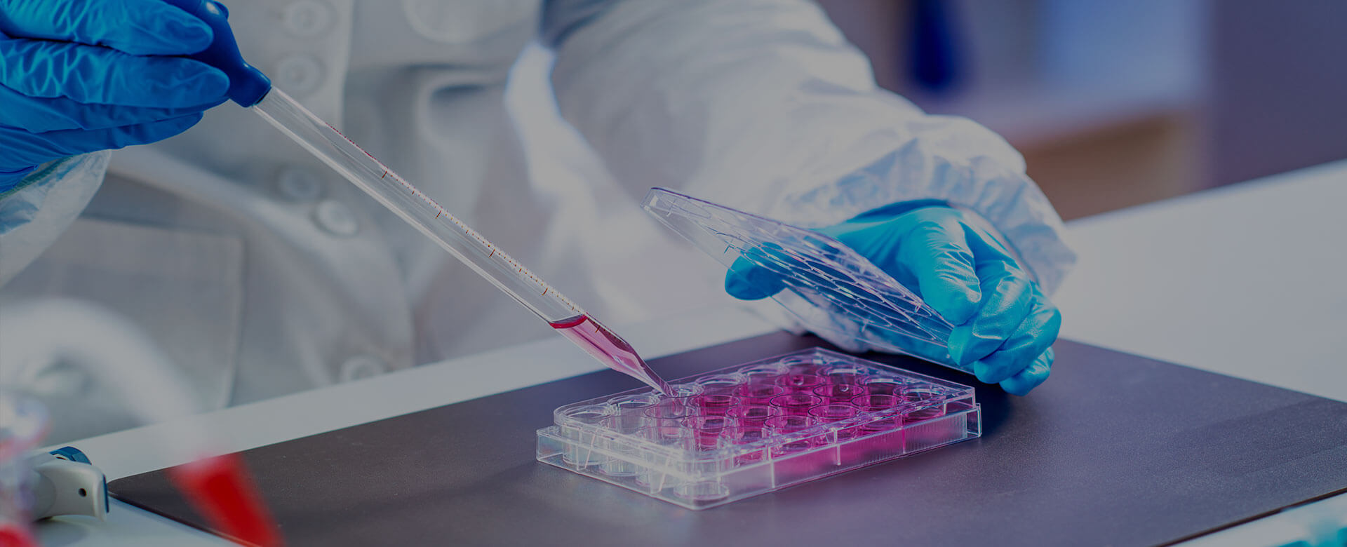 Cellule staminali mesenchimali, confermate fattibilità e sicurezza delle infusioni