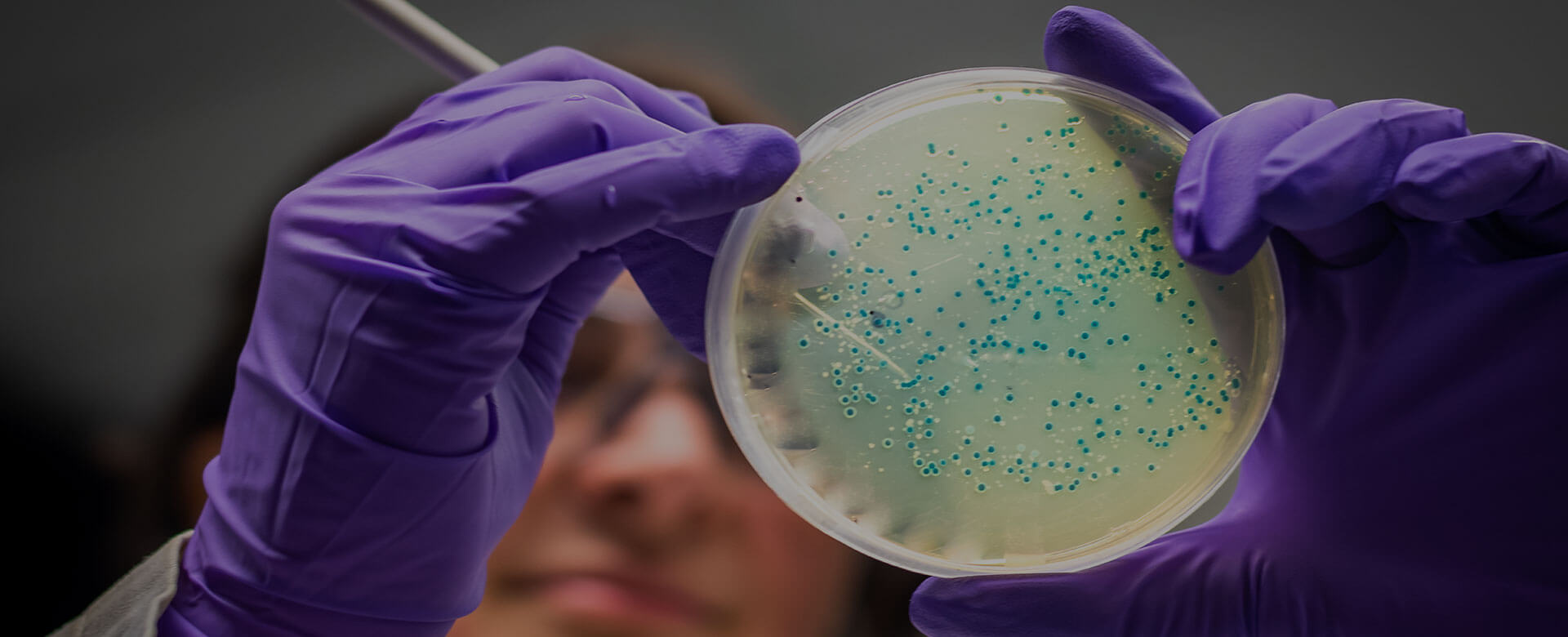 Cancer, the microbiome helps to improve therapy outcomes
