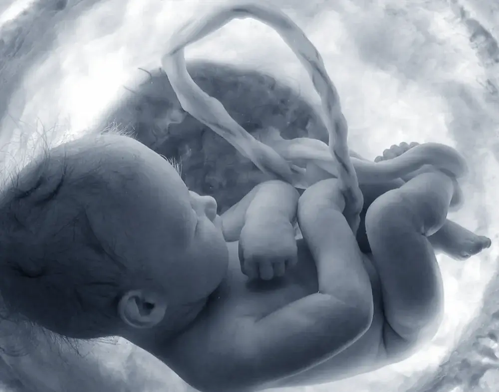 Umbilical Cord Tissue derived Stem Cells
